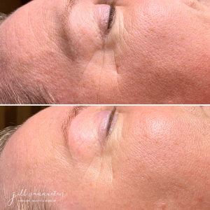 Resultaat anti-rimpel Gelaatsverzorging Zutendaal Limburg Jill Vannueten | Skincare, Beauty & Make-up