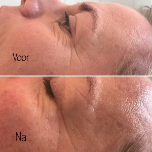 Resultaat Skincare anti-age gelaatsverzorging door Jill Vannueten